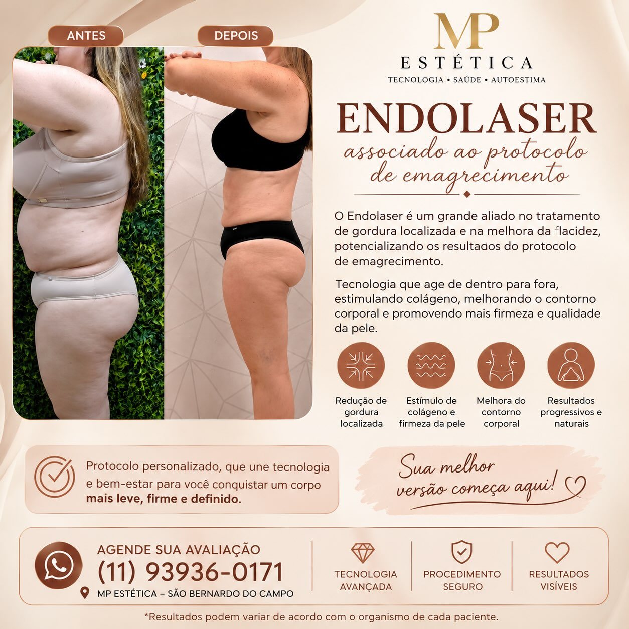 Resultado do protocolo Endolaser